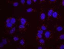 ATR Antibody, Novus Biologicals 0.1mg; Unlabeled:Antibodies, Polyclonal