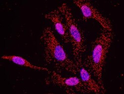 ATR Antibody, Novus Biologicals 0.1mg; Unlabeled:Antibodies, Polyclonal