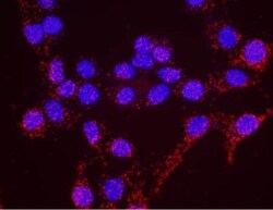 ATR Antibody, Novus Biologicals 0.1mg; Unlabeled:Antibodies, Polyclonal