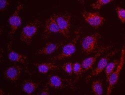 ATR Antibody, Novus Biologicals 0.1mg; Unlabeled:Antibodies, Polyclonal