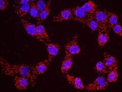 ATR Antibody, Novus Biologicals 0.1mg; Unlabeled:Antibodies, Polyclonal