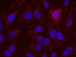 ATR Antibody, Novus Biologicals 0.1mg; Unlabeled:Antibodies, Polyclonal