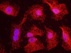 ATR Antibody, Novus Biologicals 0.1mg; Unlabeled:Antibodies, Polyclonal