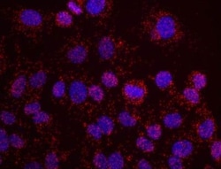 ATR Antibody, Novus Biologicals 0.1mg; Unlabeled:Antibodies, Polyclonal