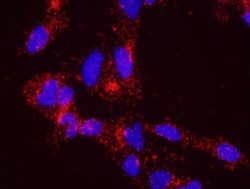 ATR Antibody, Novus Biologicals 0.1mg; Unlabeled:Antibodies, Polyclonal