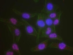 ATR Antibody, Novus Biologicals 0.1mg; Unlabeled:Antibodies, Polyclonal