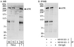 ATR Antibody, Novus Biologicals 0.1mg; Unlabeled:Antibodies, Polyclonal