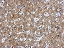 preproANP Antibody, Novus Biologicals 0.1mL; Unlabeled:Antibodies, Polyclonal
