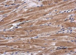 preproANP Antibody, Novus Biologicals 0.1mL; Unlabeled:Antibodies, Polyclonal