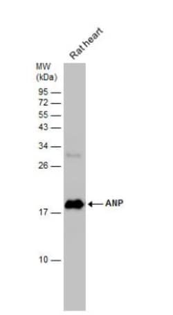 preproANP Antibody, Novus Biologicals 0.1mL; Unlabeled:Antibodies, Polyclonal