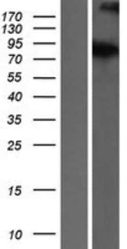 Novus Biologicals™ ATRIP Overexpression Lysate