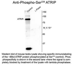 ATRIP, p Ser239 Antibody, Novus Biologicals 0.1mL; Unlabeled:Antibodies,