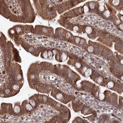 ATRNL1 Antibody, Novus Biologicals:Antibodies:Primary Antibodies