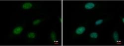 ATRX Antibody (4212), Novus Biologicals 0.1mL; Unlabeled:Antibodies, Monoclonal