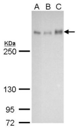 ATRX Antibody (4212), Novus Biologicals 0.1mL; Unlabeled:Antibodies, Monoclonal