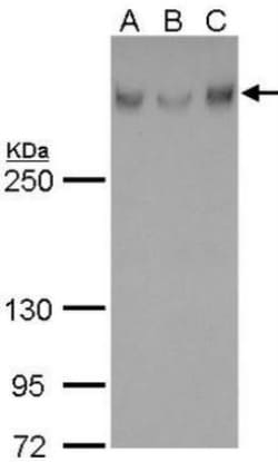 ATRX Antibody (4212), Novus Biologicals 0.1mL; Unlabeled:Antibodies, Monoclonal