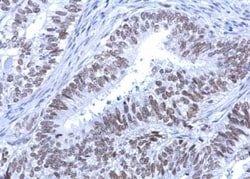 ATRX Antibody, Novus Biologicals 0.1mL; Unlabeled:Antibodies, Polyclonal