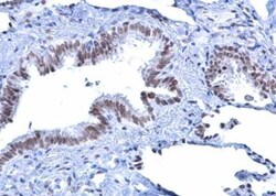 ATRX Antibody, Novus Biologicals 0.1mL; Unlabeled:Antibodies, Polyclonal