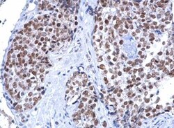 ATRX Antibody, Novus Biologicals 0.1mL; Unlabeled:Antibodies, Polyclonal
