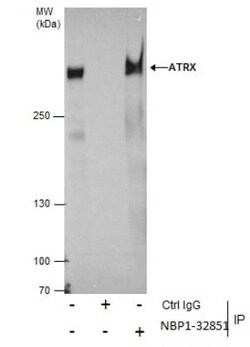 ATRX Antibody, Novus Biologicals 0.1mL; Unlabeled:Antibodies, Polyclonal