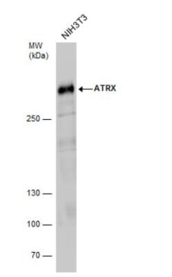 ATRX Antibody, Novus Biologicals 0.1mL; Unlabeled:Antibodies, Polyclonal