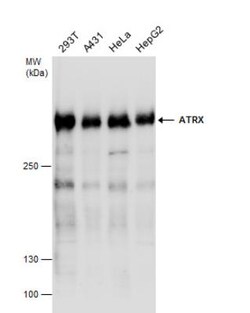 ATRX Antibody, Novus Biologicals 0.1mL; Unlabeled:Antibodies, Polyclonal