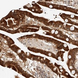 ATXN7L2 Antibody, Novus Biologicals:Antibodies:Primary Antibodies