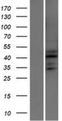 Novus Biologicals&trade;&nbsp;ATXN7L2 Overexpression Lysate