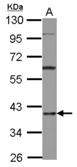 AUF1 Antibody, Novus Biologicals 0.1mL; Unlabeled:Antibodies, Polyclonal
