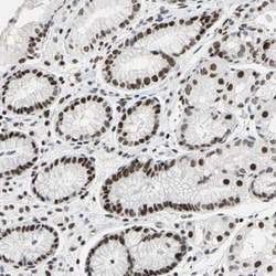 AUF1 Antibody, Novus Biologicals:Antibodies:Primary Antibodies