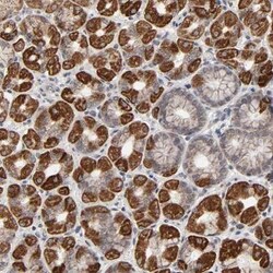 AUH Antibody, Novus Biologicals:Antibodies:Primary Antibodies