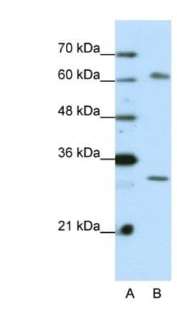 AUH Antibody, Novus Biologicals:Antibodies:Primary Antibodies