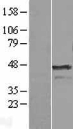 Novus Biologicals™ Aurora A Overexpression Lysate