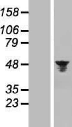 Novus Biologicals™ Aurora A Overexpression Lysate