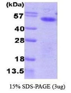 Novus Biologicals&trade;&nbsp;Recombinant Human Aurora A His Protein