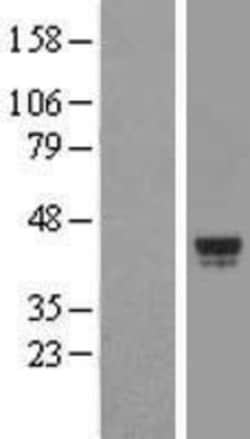 Novus Biologicals™ aurora A-binding protein Overexpression Lysate