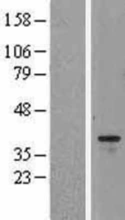 Novus Biologicals&trade;&nbsp;Aurora B Overexpression Lysate