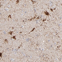 Aurora A Antibody, Novus Biologicals 25 &mu;L | Buy Online | Novus Biologicals | Fisher Scientific