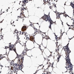 aurora A-binding protein Antibody, Novus Biologicals 0.1mL; Unlabeled:Antibodies,