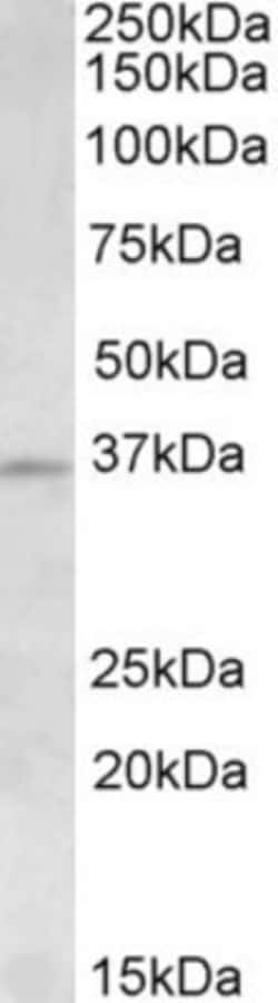 Aurora C Antibody, Novus Biologicals 0.1mg; Unlabeled:Antikörper