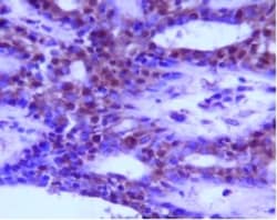 Novus Biologicals™ Autophagy Antibody Pack