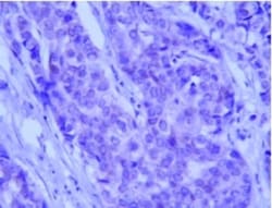 Novus Biologicals Autophagy Antibody Pack 2 vials:Antibodies