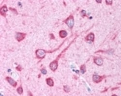 Novus Biologicals Autophagy Antibody Pack 2 vials:Antibodies