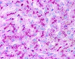 Novus Biologicals Autophagy Antibody Pack 2 vials:Antibodies