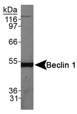 Novus Biologicals Autophagy Antibody Pack 2 vials:Antibodies