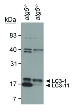 Novus Biologicals Autophagy Antibody Pack 2 vials:Antibodies