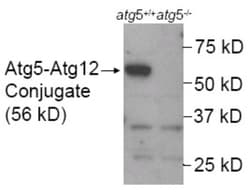 Novus Biologicals Autophagy Antibody Pack 2 vials:Antibodies