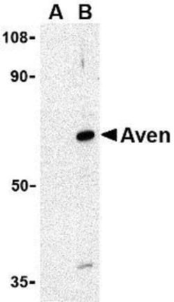 AVEN Antibody, Novus Biologicals 0.1mg; Unlabeled:Antibodies, Polyclonal