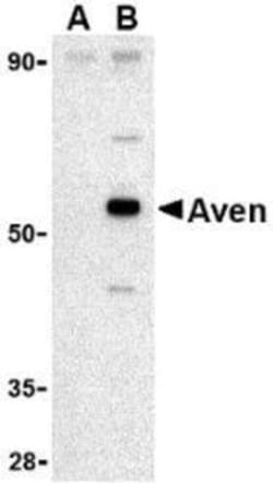 Novus Biologicals AVEN Antibody Blocking Peptide 0.05 mg | Buy Online | Novus Biologicals&trade; | Fisher Scientific