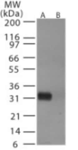 Avian Influenza A H6N1 Hemagglutinin Antibody, Novus Biologicals:Antibodies:Primary